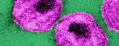 HIV-Viruspartikel im Elektronenmikroskop HIV-Viruspartikel im Elektronenmikroskop