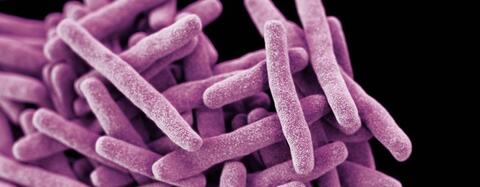 Tuberculosis bacteria under the electron microscope. Tuberculosis bacteria