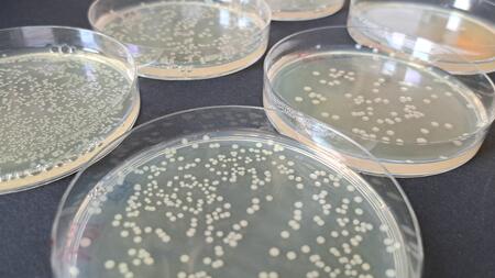 Six Petri dishes can be seen on a dark grey table surface. On a liquid, different large amounts of bacteria grow in the Petri dishes in a circlular pattern.