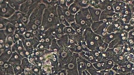 Primary human liver cells