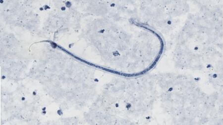 Image of a microfilaria of the roundworm Loa Loa, taken at 100x magnification.