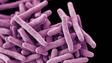 Tuberkulosebakterien