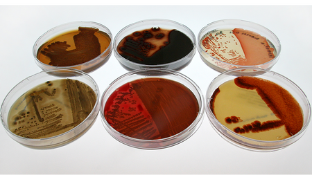 Six Petri dishes with different microorganisms from the collection of the Leibniz Institute DSMZ-German Collection of Microorganisms and Cell Cultures