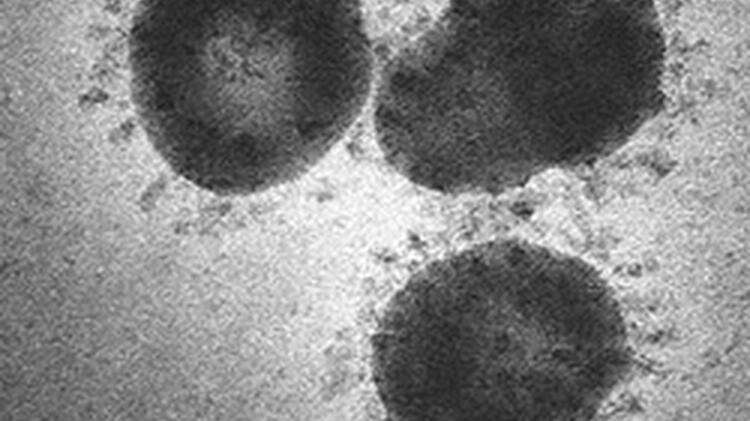 Coronavirus_CDC_fuer_Pressemitteilung-25
