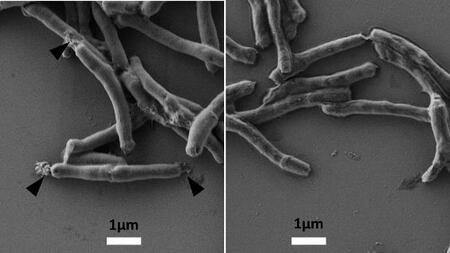 Tuberkulosebakterien: (links) mit BTZ043 behandelt laufen die Zellen aus; (rechts) unbehandelt