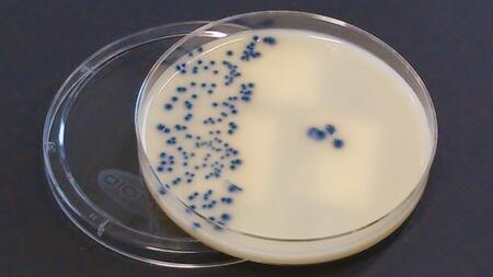 Multiresistente Bakterien auf einer Agarplatte
