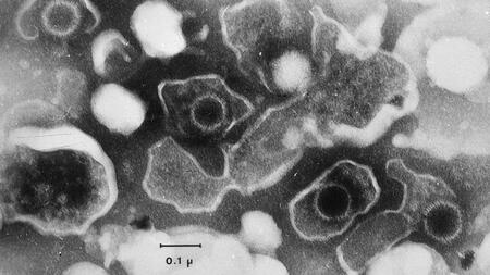 Das Epstein-Barr-Virus (EBV) hindert infizierte Zellen daran, sich beim Immunsystem bemerkbar zu machen.