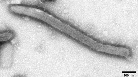 Schwarz-Weiß-EM-Aufnahme eines Ebola-Virus.