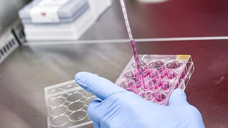 A left hand in a blue lab glove, holding a 12-wells-cell culture plate that is being filled with culture medium by a transparent plastic pipet, of which only the lower part can be seen.
