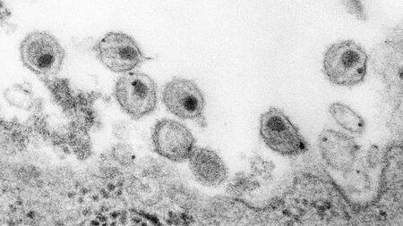 Transmissionselektronenmikroskopische Aufnahme von Human Immunodeficiency Virus Partikeln in einer Lymphozyten-Co-Kultur.