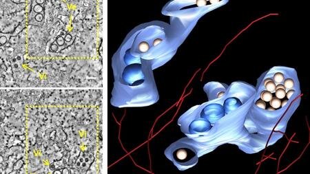 Electron tomography