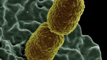 Klebsiella pneumoniae