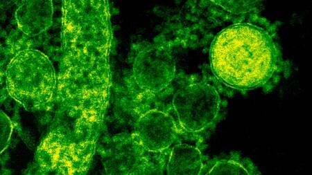 Elektronenmikroskopische Aufnahme von grün-gefärbten MERS-Coronaviren. Gut sichtbar sind die Spike-Proteine auf der Oberfläche der runden Virenpartikel, die als "Krone" den Coronaviren ihren Namen geben.