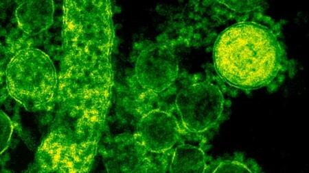 MERS Corona virus particles outside the cell