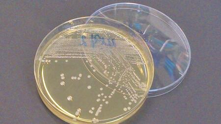 Multi-resistant E. coli bacteria in a petri dish