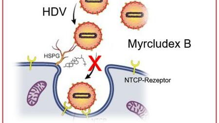 Myrcludex B inhibits also the entry of Hepatitis D (HDV) into the liver cell