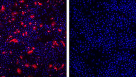 No entry for Hepatitis D viruses (red; left) in hepatocytes with Myrcludex B (right).