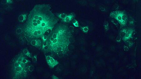 Monkey kidney cells infected with MERS