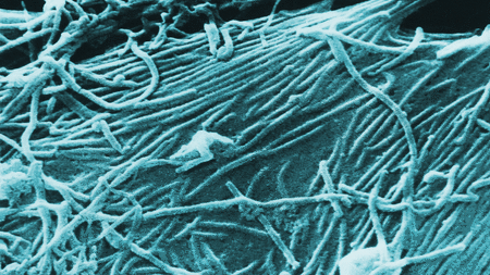 Electron microscope images of Ebola virus particles