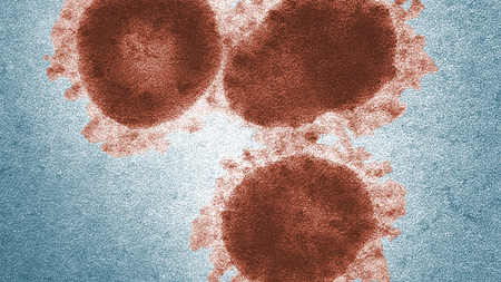 Coronaviruses can cause the highly infectious and potentially lethal respiratory illnesses MERS and SARS.