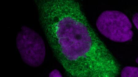 Shown on a black background are about 12 nuclei of lung cells in purple and a green-stained oval SARS-CoV-2 virus particle.