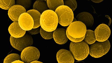 Electron microscopic image of several cells of the pathogenic bacterium Staphylococcus aureus. The spheric bacterial cells are coloured in yellow and shown in front of a dark background.