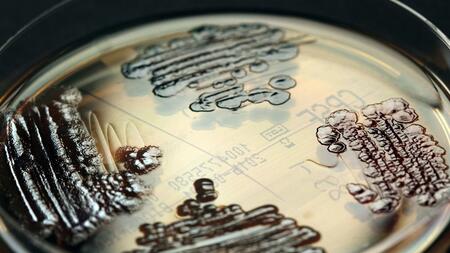 Multidrug-resistant Enterobacteriaceae shown in a petri dish
