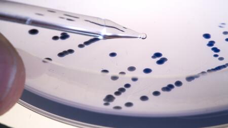 Petri dish