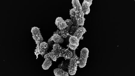 Electron micrograph of Klebsiella oxytoca bacteria.
