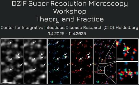 DZIF Super Resolution Microscopy Workshop – Theory and Practice