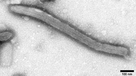 Black-and-white electron microscope image of an Ebola virus.