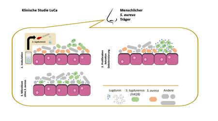 Übersichtsgrafik auf der klinischen Studie LuCa