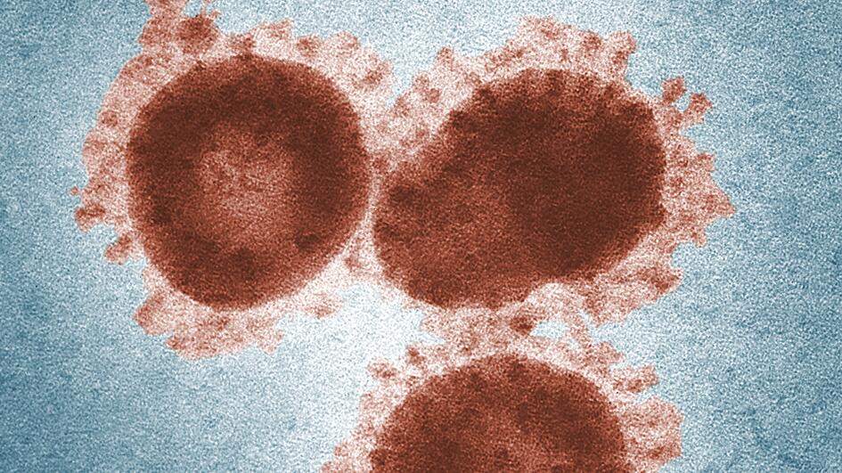 Researchers Develop First Diagnostic Test For Novel Coronavirus In China German Center For Infection Research