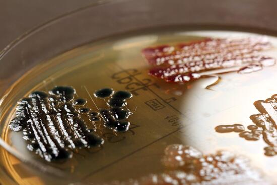 Hospital pathogens in a petri-dish