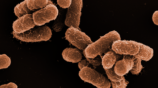 EM image of brown-coloured rod-shaped Klebsiella bacteria 