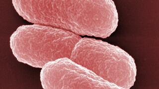 The image shows a highly magnified electron micrograph of several oval, slightly rough Escherichia coli bacterial cells. The colour of the image is a reddish tone. The background is dark and highlights the bacteria.