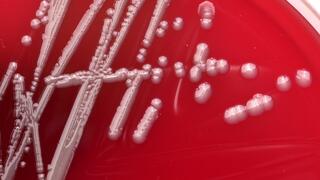 Whitish Acinetobacter baumannii colonies on a red agar plate