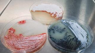 Drei Agarplatten mit Streptomyces-Kolonien in verschiedenen Farben (rötlich, blau, orange).