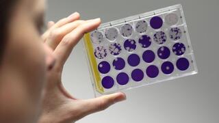 Antibody test system