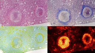 Four single images of differently stained tissue sections with  enclosed tuberculosis granuloma showing different structural elements and accumulated BTZ-043.