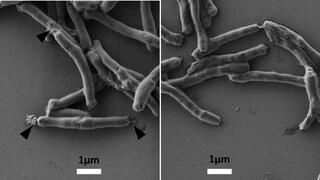 Tuberkulosebakterien: (links) mit BTZ043 behandelt laufen die Zellen aus; (rechts) unbehandelt