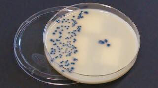 Multiresistente Bakterien auf einer Agarplatte