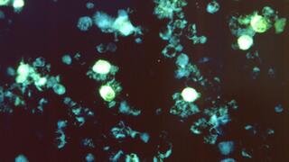 Epstein Barr virus in cells