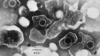 Das Epstein-Barr-Virus (EBV) hindert infizierte Zellen daran, sich beim Immunsystem bemerkbar zu machen.