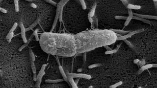 Enterobacter