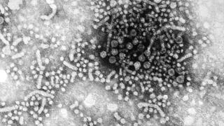 Negative-stained transmission electron micrograph in black and white of round hepatitis B virus particles in white, in which internal structures are visible, against a dark background.