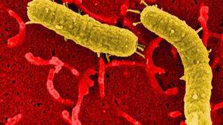 Electron micrograph of two H. pylori cells in yellow binding to human gastric epithelial cells (stained red below).