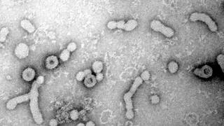 Elektronenmikroskopische Aufnahme von Hepatitis-B-Viren (große ovale Strukturen mit dunklem Kern) und nicht-infektiöse Virushüllen (kleine runde bzw. längliche Strukturen)