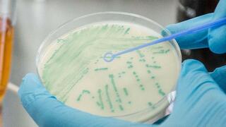 Blue bacterial colonies growing on an agar plate with yellow agar, held by a hand in a blue glove. A plastic inoculation loop held by another gloved hand is hovering over the colonies aiming to pick a colony..