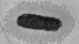 Schwarz-Weiß-Elektronenmikroskopaufnahme einer stäbchenförmigen, dunkelgrauen Bakterienzelle, die von einer dicken Schicht hellgrauer Filamente umgeben ist.